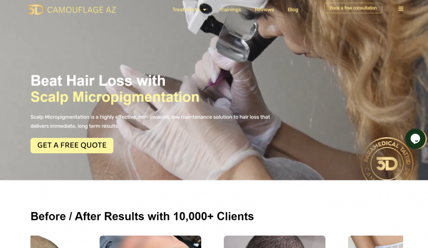 Scalp Micropigmentation Company